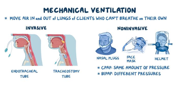 Nursing care advanced airways and mechanical ventilation edapt